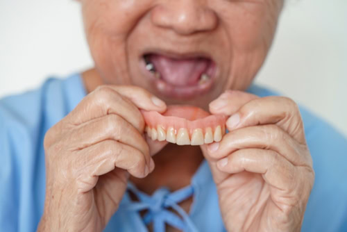 Dentaduras Flotantes en Austin, TX | Estabilización de Dentaduras | Mini Implante