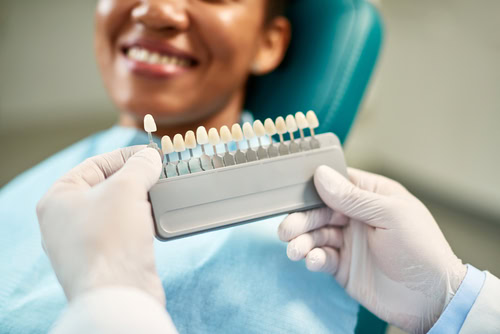 Veneers Cost in Cleveland, TN | Center for Cosmetic Dentistry