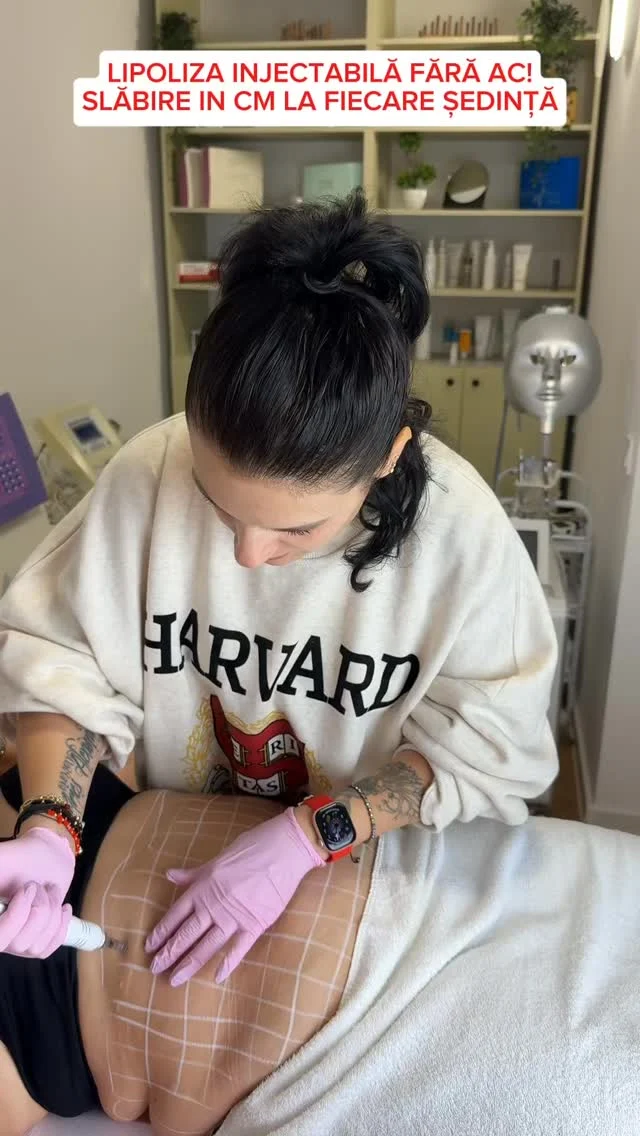 🤭Când vii din Constanța până la București pentru lipoliză injectabilă fără ac, știi că este ceva ce merită🔥
✨Zero ace, zero durere, doar rezultate! 
 Rezultate vizibile, fără durere, fără perioadă de recuperare – doar slăbire in centimetri, remodelare corporală și o piele mai fermă.
🫶Mulțumim pentru încredere și pentru drumul făcut până la noi! 💕
Tu ai încerca? 💉👇 
Dacă crei și tu, scrie " VREAU " in comentarii și eu revin către tine cu detalii și programare.
#angelrosesalon #lipoliza #foryoupage❤️❤️ #beauty #remodelarecorporala