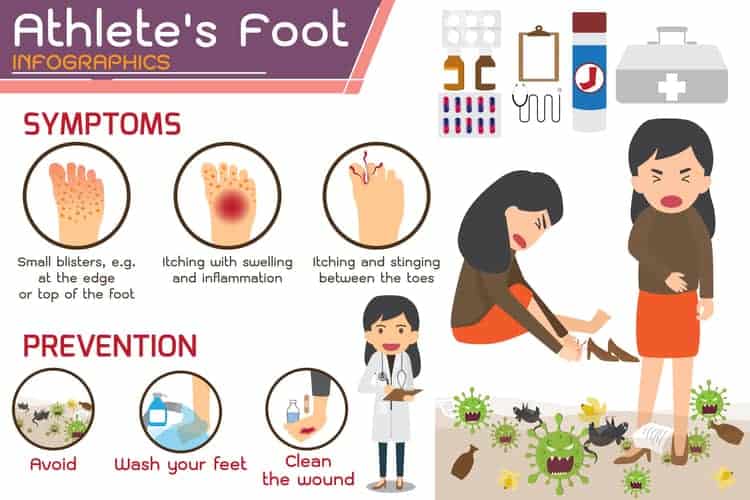 Athlete's Foot Info-graphic