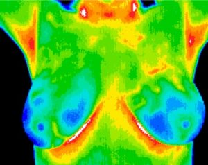 thermography