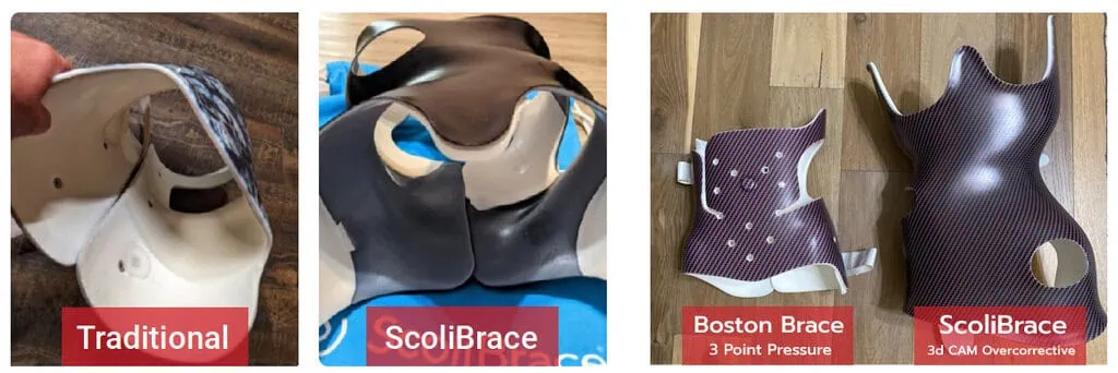 drjustintrosclair.com%2Fwp content%2Fuploads%2F2024%2F06%2Ftwo braces boston 2