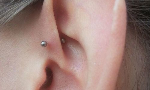 Forward-Helix-Berlin-1c Forward-Helix-Berlin-1c