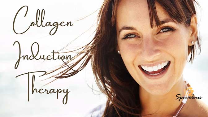 INCREDIBLE MEDSPA ACNE TREATMENT OPTIONS: LASER THERAPY OR PEELS 4 collagen induction therapy