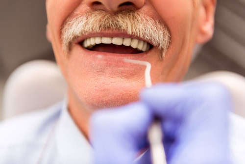 Dental-Implants-in-Union-City-NJ-Diana-Rodriguez-DMD-New-Jersey-Implant-Dentist - Elderly,Man,On,A,Review,Of,A,Dentist,,Sitting,In